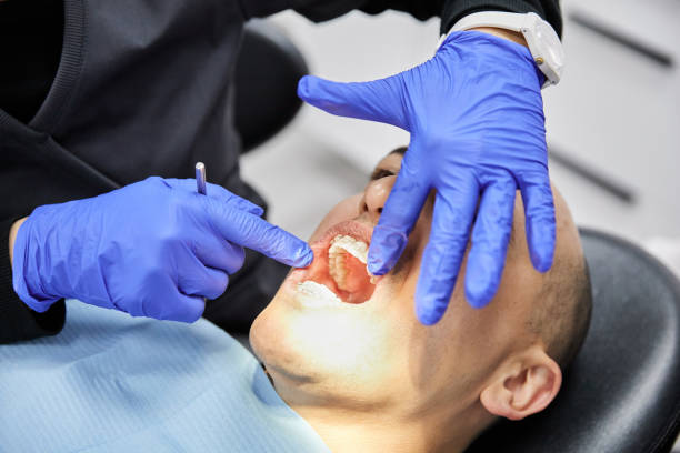 Best Emergency Dentist for Knocked-Out Tooth in Greenwood, SC